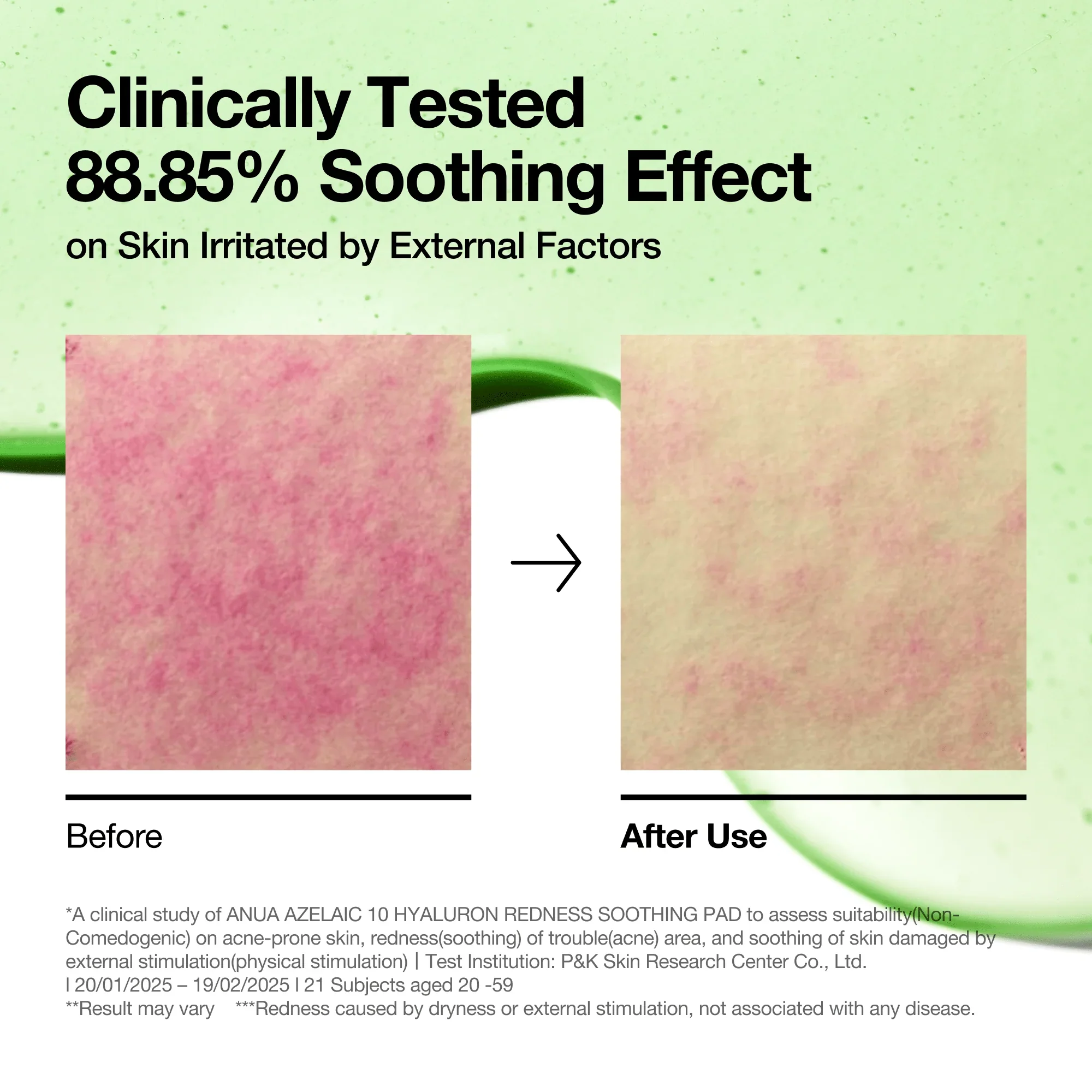 Anua Azelaic 10 Hyaluron Redness Soothing Pad, 90 dischetti - Image 3