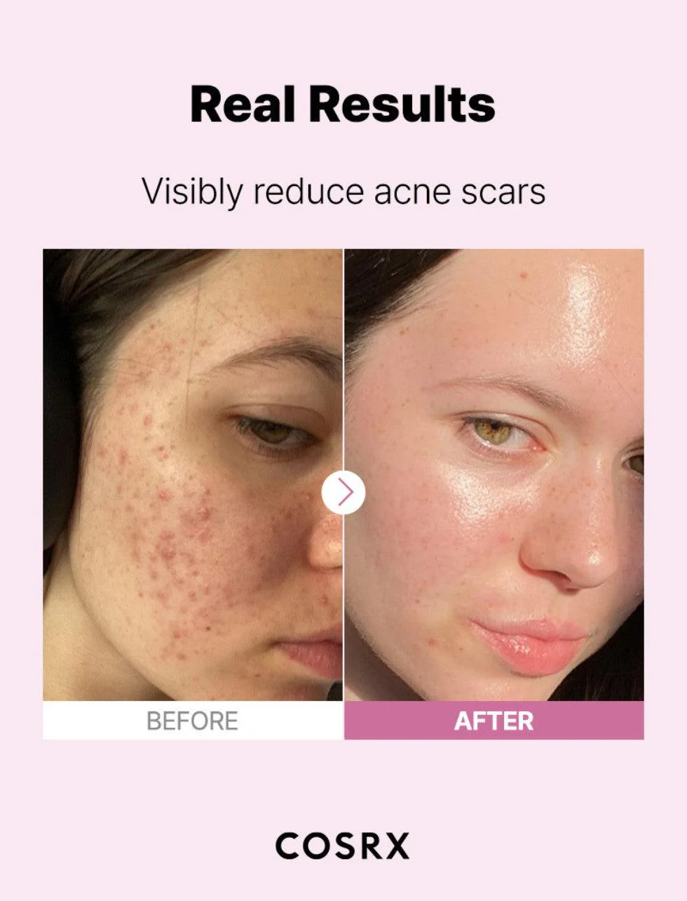 COSRX The Niacinamide 15 Serum, 20ml - Image 3