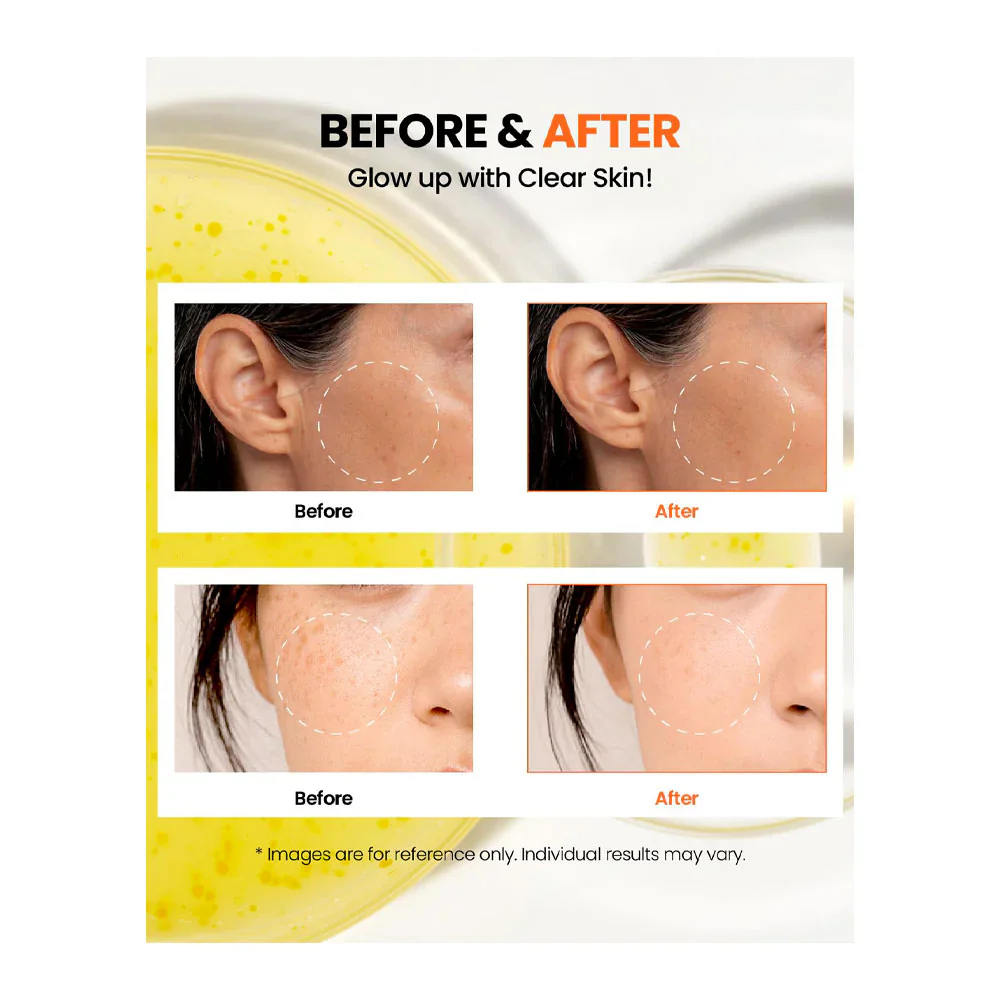 KSECRET SEOUL 1988 Glow Serum: Niacinamide 15% + Yuja, 30ml - Image 3