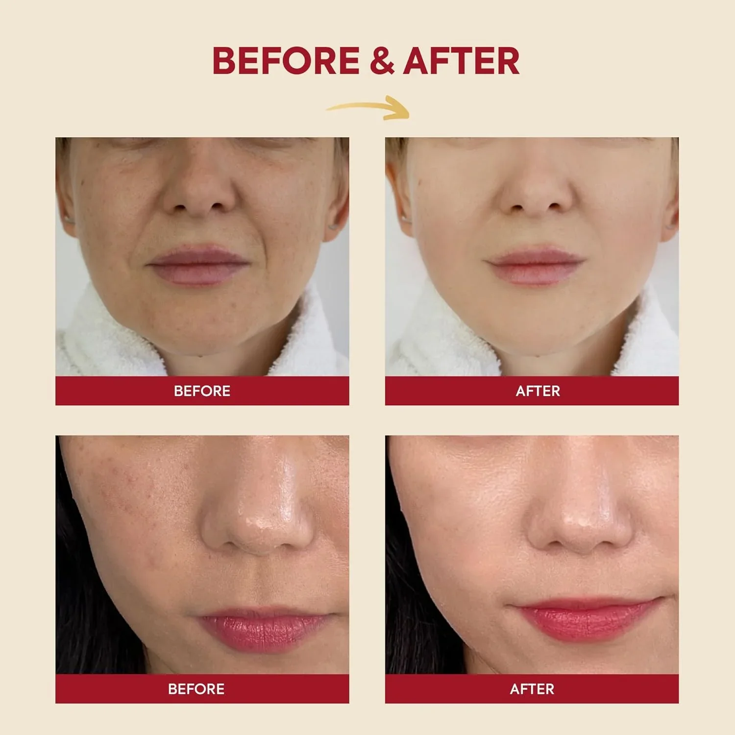 KSECRET SEOUL 1988 Essence: Snail Mucin 97% + Rice, 100ml - Image 3