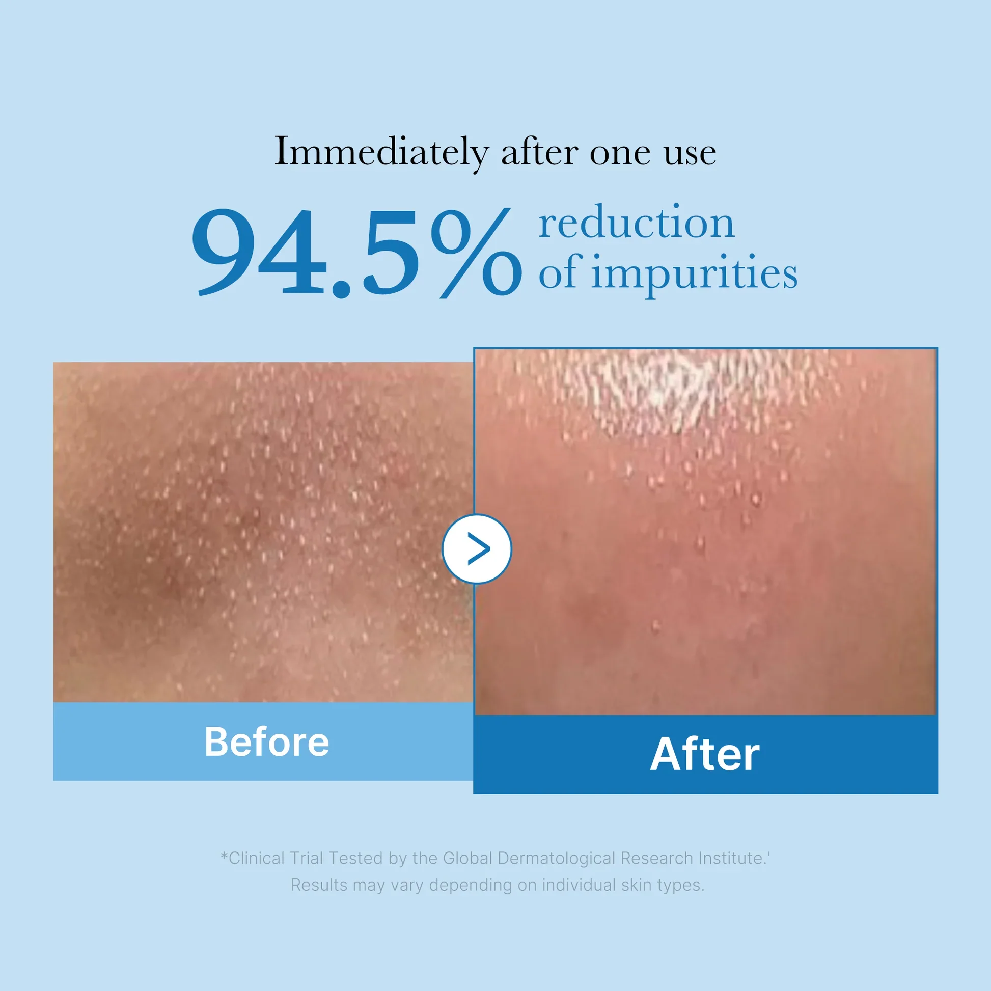 MEDICUBE Zero Pore Blackhead Deep Cleansing Oil, 205ml - Image 3