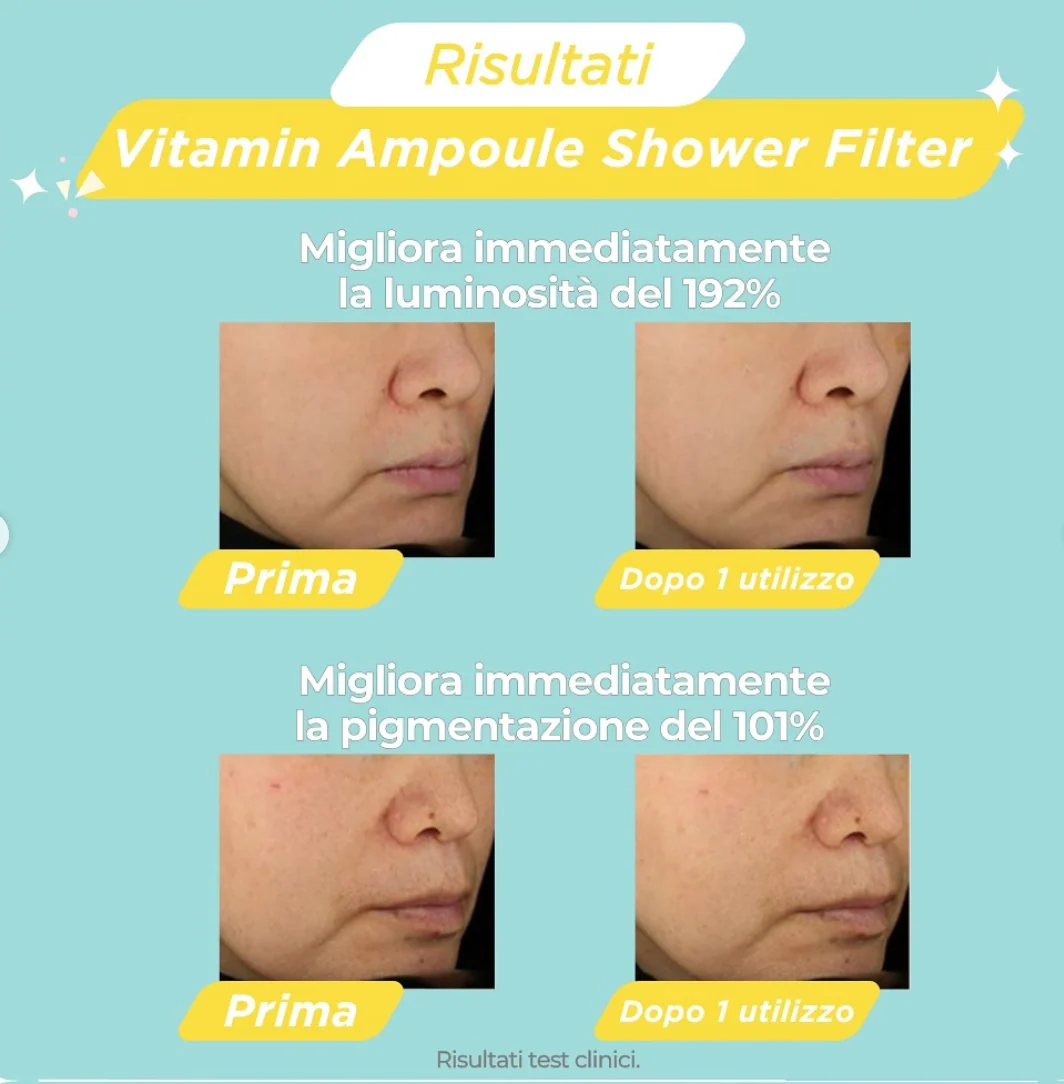 NOT4U Vitamin Ampoule Shower Filter - Image 2