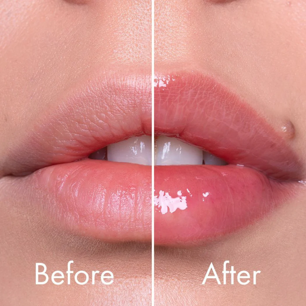 VT COSMETICS Reedle Shot Lip Plumper Expert, 4.3g - Image 2